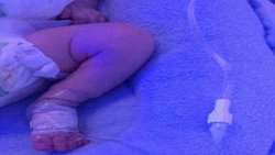 انجام پروسیجر های PICC در بخش NICU مرکز آموزشی درمانی پزوهشی امیرالمومنین (ع)